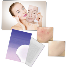 Carica l'immagine nel visualizzatore di Gallery, Confezione da 36 cerotti invisibili per l'acne - Ozerty