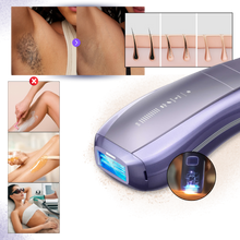 Carica l'immagine nel visualizzatore di Gallery, Dispositivo di Depilazione SkinSync - Ozerty