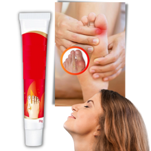 Carica l'immagine nel visualizzatore di Gallery, Crema antinfiammatoria per l'alluce valgo - Ozerty
