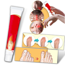 Carica l'immagine nel visualizzatore di Gallery, Crema antinfiammatoria per l'alluce valgo - Ozerty

