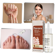 Carica l'immagine nel visualizzatore di Gallery, Essenza per la riparazione delle unghie 7 giorni - Ozerty
