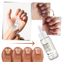 Carica l'immagine nel visualizzatore di Gallery, Essenza per la riparazione delle unghie 7 giorni - Ozerty
