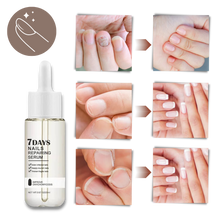 Carica l'immagine nel visualizzatore di Gallery, Essenza per la riparazione delle unghie 7 giorni - Ozerty
