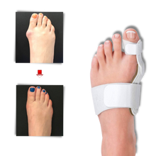 Carica l'immagine nel visualizzatore di Gallery, Correttore ortopedico di alluce valgo - Ozerty
