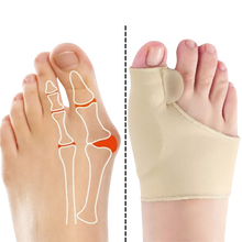 Carica l'immagine nel visualizzatore di Gallery, Correttore di alluce valgo in gel - Ozerty
