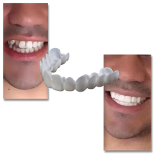 Carica l'immagine nel visualizzatore di Gallery, Copertura dentale del sorriso perfetto - faccette confortevoli - Ozerty
