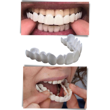 Carica l'immagine nel visualizzatore di Gallery, Copertura dentale del sorriso perfetto - faccette confortevoli - Ozerty
