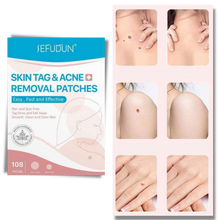 Carica l'immagine nel visualizzatore di Gallery, Cerotto per il trattamento di rimozione delle escrescenze della pelle - Ozerty
