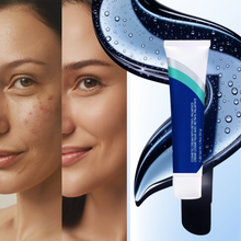 Carica l'immagine nel visualizzatore di Gallery, Crema Rivitalizzante al Retinolo - Ozerty
