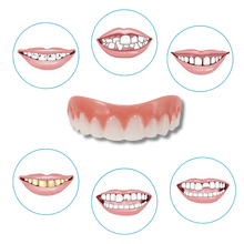 Carica l'immagine nel visualizzatore di Gallery, Faccette dentali a scatto - Ozerty
