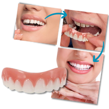 Carica l'immagine nel visualizzatore di Gallery, Faccette dentali a scatto - Ozerty
