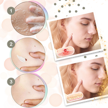 Carica l'immagine nel visualizzatore di Gallery, Crema Ultra Idratante al Veleno D'api - Ozerty
